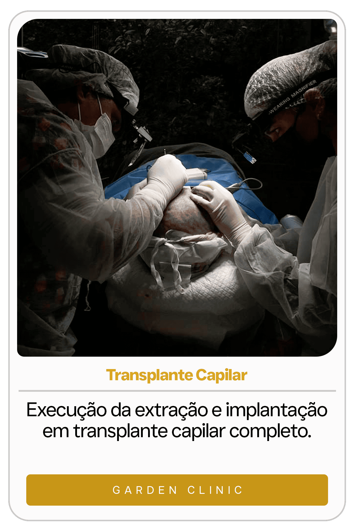 transplante capilar